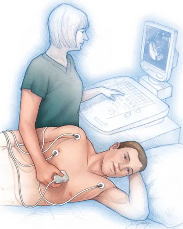 Echocardiography(ECHO)