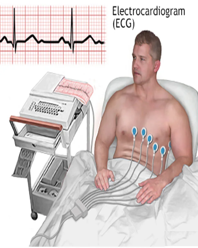 Electrocardiogram (ECG or EKG)