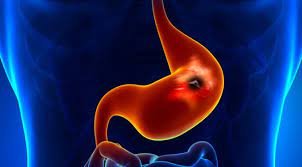 Best Gastrologist in Jagatpura