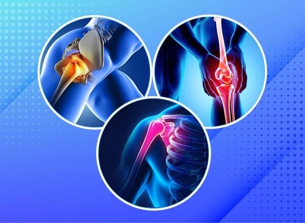 Joint Replacement Surgeon in Pratap Nagar